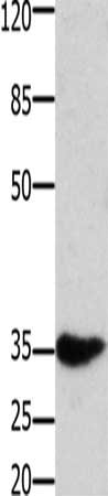 HOXA11 Antibody