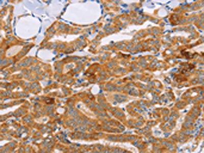 CARD6 Antibody