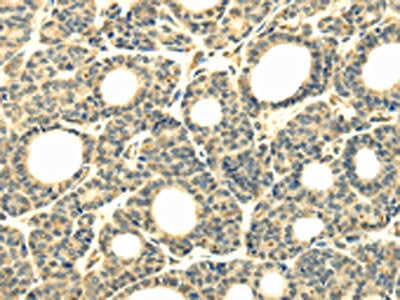 WDR45B Antibody