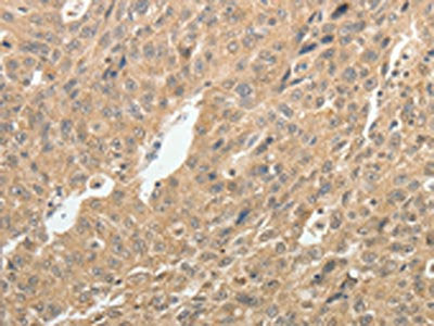 TH Antibody