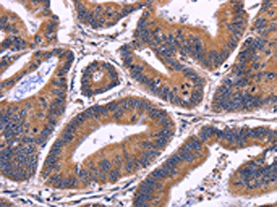 SPATA7 Antibody