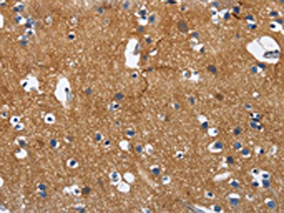CADM3 Antibody