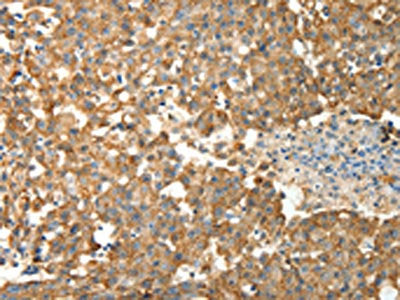 PRDX3 Antibody