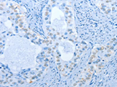 NAE1 Antibody