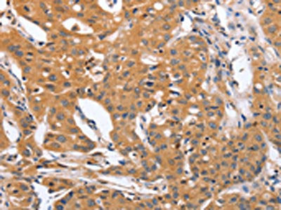 BLNK Antibody