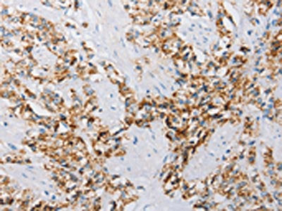 ATG4C Antibody