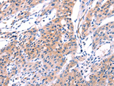 VWF Antibody