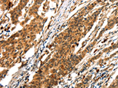 BCLAF1 Antibody
