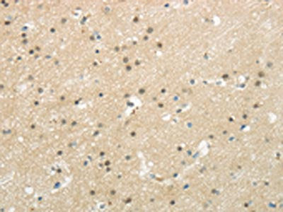 BAZ1B Antibody
