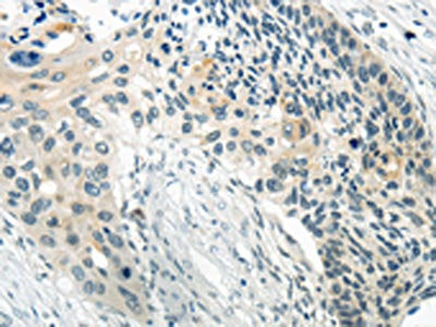 WNT2B Antibody
