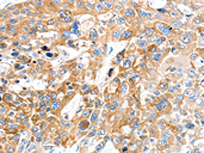SLC22A17 Antibody