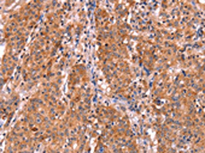 ABI1 Antibody