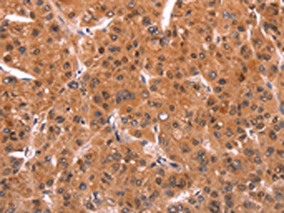 EMP2 Antibody