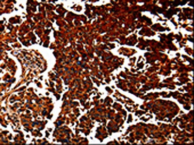 ANXA7 Antibody