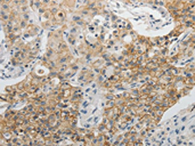 CDH3 Antibody