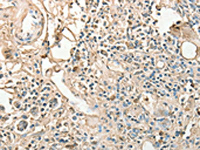 AGBL2 Antibody