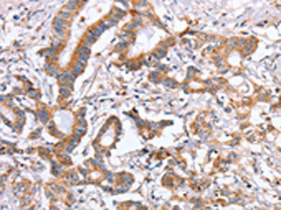 ITGB5 Antibody