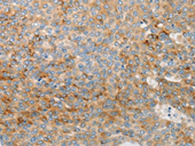 IGFBP1 Antibody