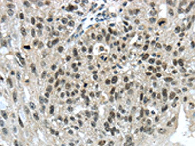 TRIM24 Antibody