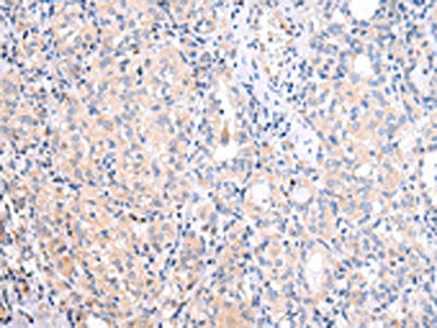 ATF6 Antibody