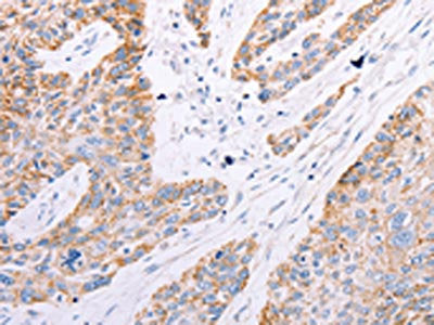 GFRA3 Antibody