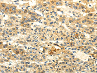 BRWD1 Antibody