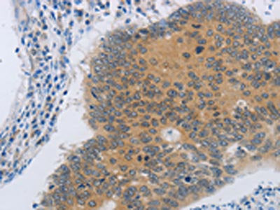NDRG4 Antibody