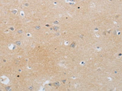 MMP25 Antibody