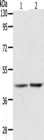 AGXT Antibody