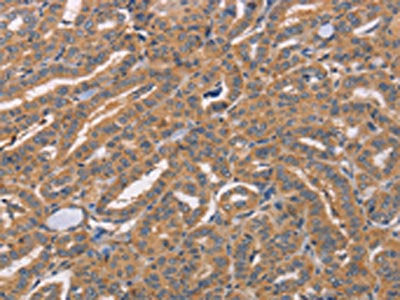 CDCA4 Antibody