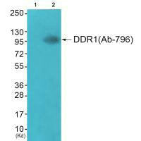 DDR1 (Ab-796) Antibody