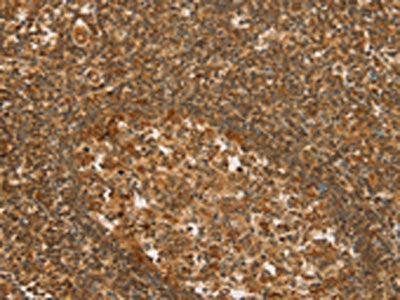 SLC6A3 Antibody
