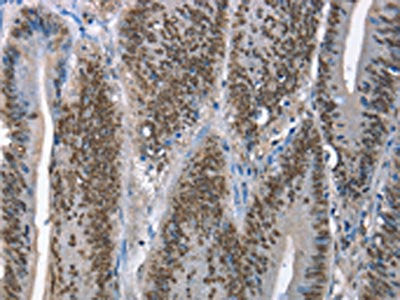 GNRH1 Antibody