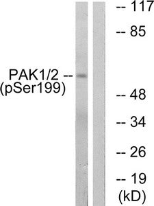 Phospho-PAK1 (Ser199) Antibody