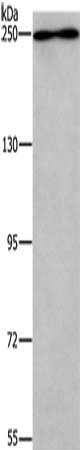 WNK3 Antibody