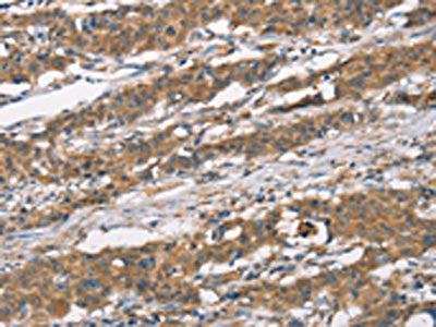 MARC1 Antibody