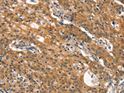 DNM2 Antibody