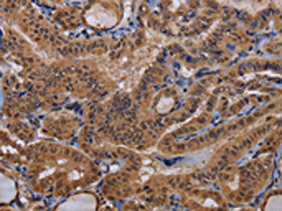 MCTS1 Antibody