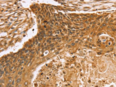 VIM Antibody