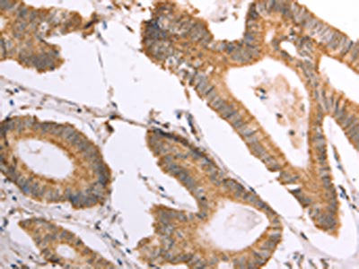 NAMPT Antibody