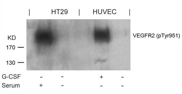 Phospho-KDR (Tyr951) Antibody