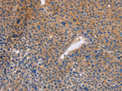 NEK8 Antibody