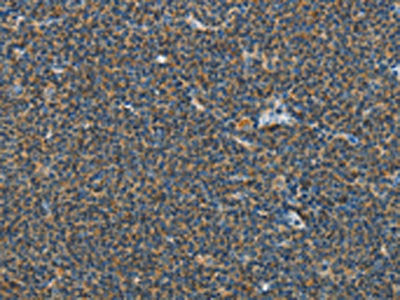 PITX3 Antibody