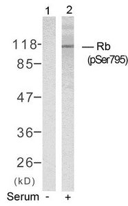 Phospho-RB1 (Ser795) Antibody