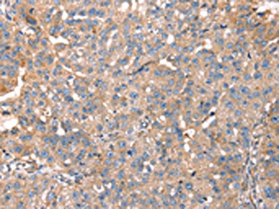 PDLIM4 Antibody