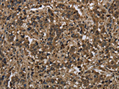 KSR1 Antibody