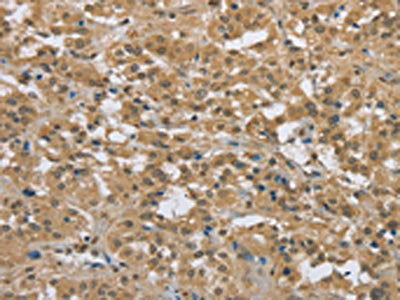 PKD1 Antibody