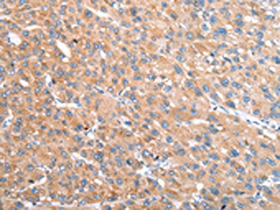 VPS16 Antibody