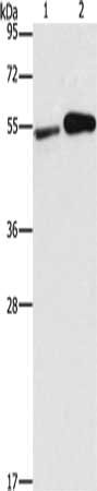 FSCN1 Antibody
