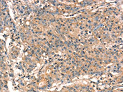 STK17A Antibody